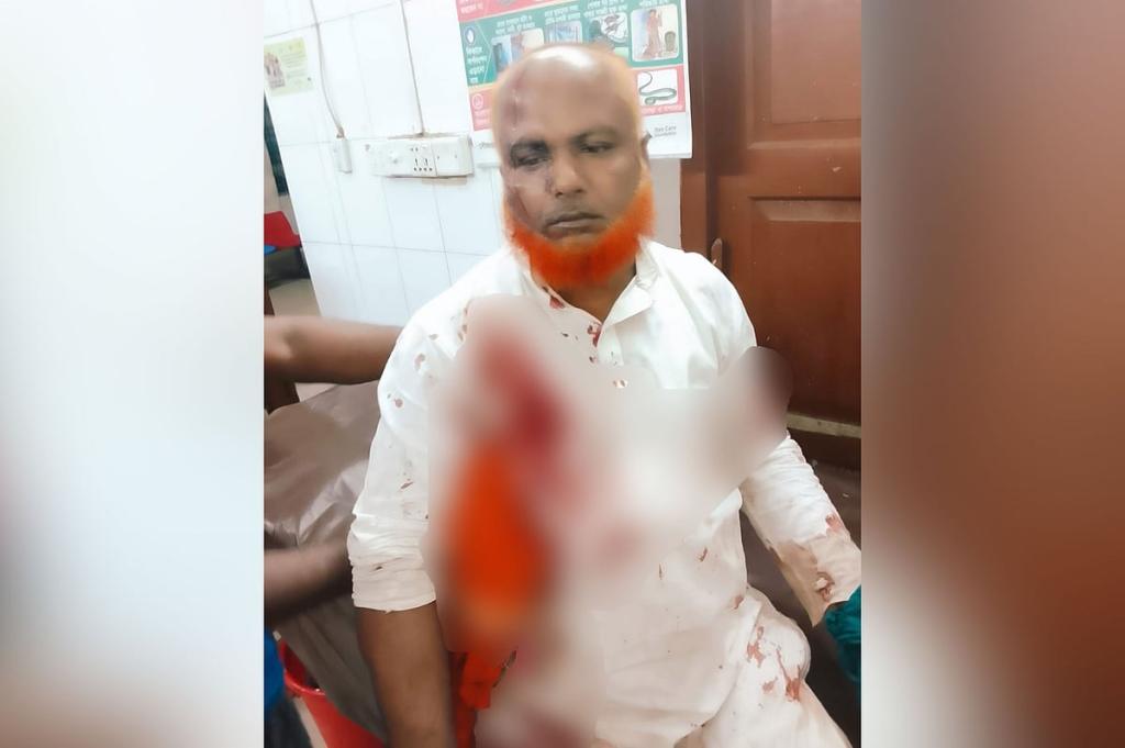 সাতকানিয়ার ধারালো অস্ত্র নিয়ে বিএনপির দুই পক্ষের সংঘর্ষ, ৮ নেতা-কর্মী আহত